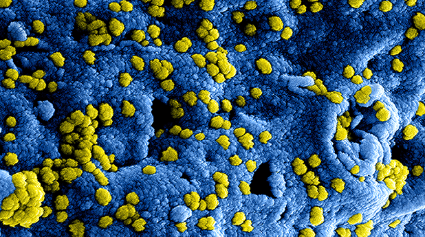 Coronavirus Analysis & Outlook – 1 September
